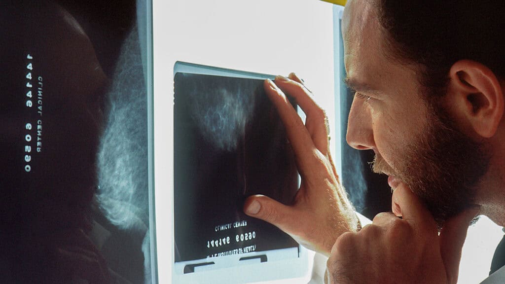 Greek Researchers Co-Author Study on AI Breast Cancer Alerts Years Before Diagnosis