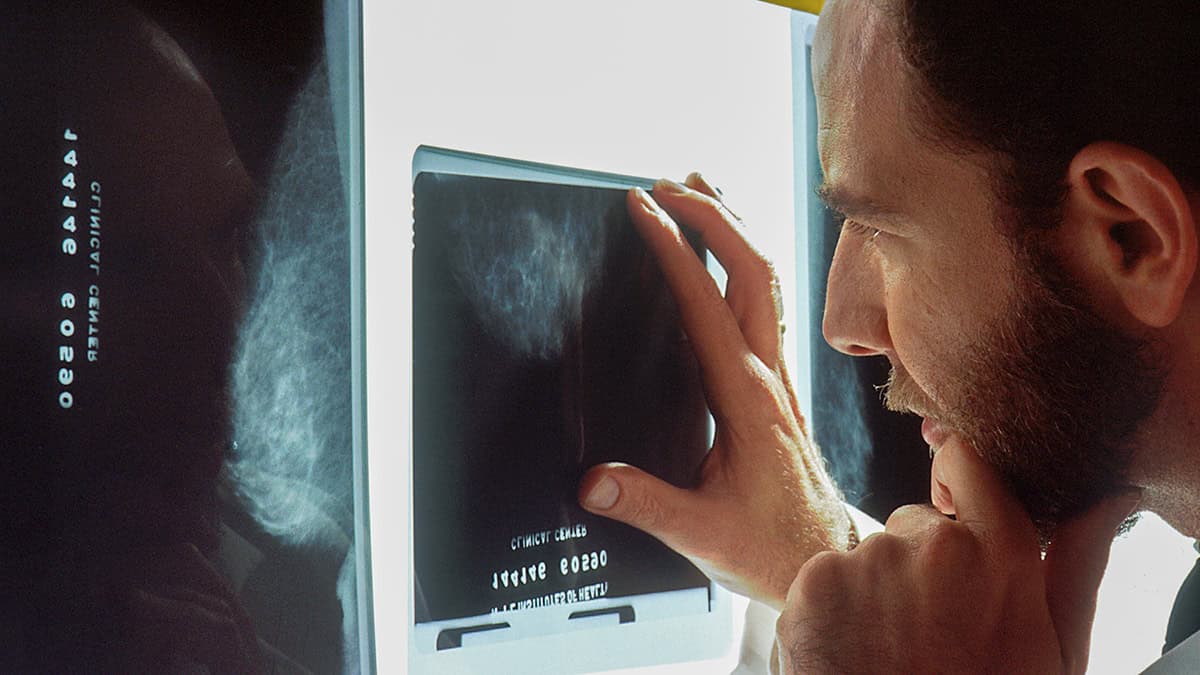 Doctor examining mammogram images on an illuminated viewing panel